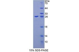 SDS-PAGE analysis of Human CIB1 Protein. (CIB1 Protein)