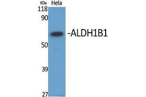 Western Blot (WB) analysis of specific cells using ALDH1B1 Polyclonal Antibody. (ALDH1B1 antibody  (Internal Region))