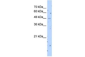 SLC22A23 antibody used at 1 ug/ml to detect target protein. (SLC22A23 antibody  (Middle Region))