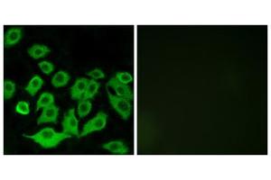Immunofluorescence analysis of A549 cells, using RPL36 antibody. (RPL36 antibody  (Internal Region))