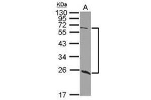 Image no. 1 for anti-Udp-N-Acetyl-alpha-D-Galactosamine:polypeptide N-Acetylgalactosaminyltransferase 9 (GalNAc-T9) (GALNT9) (AA 333-573) antibody (ABIN1498371) (GALNT9 antibody  (AA 333-573))