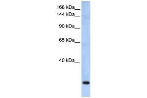 WB Suggested Anti-FBXW10 Antibody Titration: 0.