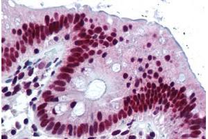 anti-Heterogeneous Nuclear Ribonucleoprotein K (HNRNPK) antibody