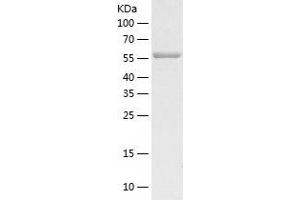 Western Blotting (WB) image for E74-Like Factor 2 (Ets Domain Transcription Factor) (ELF2) (AA 1-533) protein (His tag) (ABIN7287303) (ELF2 Protein (AA 1-533) (His tag))