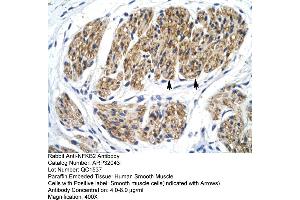 Human Smooth Muscle (NFKB2 antibody  (C-Term))