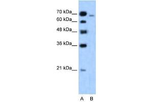 Western Blot showing MLLT4 antibody used at a concentration of 1-2 ug/ml to detect its target protein. (Afadin antibody  (N-Term))