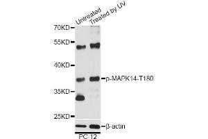 Western blot analysis of extracts of PC-12 cells, using Phospho-MAPK14-T180 antibody (ABIN5969910) at 1/2000 dilution. (MAPK14 antibody  (pThr180))