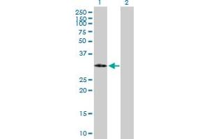 Western Blot analysis of IGFBP2 expression in transfected 293T cell line by IGFBP2 MaxPab polyclonal antibody. (IGFBP2 antibody  (AA 1-328))