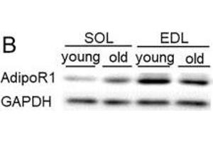 Western Blotting (WB) image for anti-Adiponectin Receptor 1 (ADIPOR1) (C-Term) antibody (ABIN2855945)