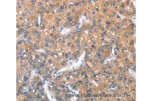 Immunohistochemistry of Human brain  using KEL Polyclonal Antibody at dilution of 1:40 (KEL antibody)