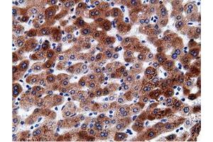 Immunohistochemical staining of paraffin-embedded Human liver tissue using anti-CD80 mouse monoclonal antibody. (CD80 antibody)