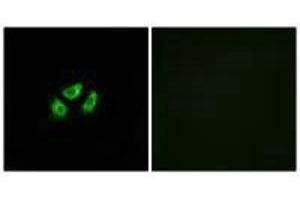 SCN7A antibody