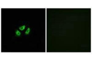 Immunofluorescence analysis of A549 cells, using SCN7A antibody. (SCN7A antibody)