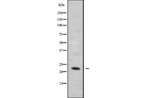 Western blot analysis GAS3 using MDA-MB-435 whole cell lysates (PMP22 antibody  (C-Term))