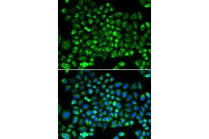 Immunofluorescence (IF) image for anti-Dynamin 1-Like (DNM1L) (AA 411-710) antibody (ABIN6219696) (Dynamin 1-Like antibody  (AA 411-710))
