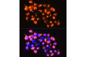 Immunofluorescence analysis of HeLa cells using EPB41L2 antibody (ABIN6131606, ABIN6140199, ABIN6140200 and ABIN6224888) at dilution of 1:100. (EPB41L2 antibody  (AA 1-210))