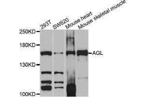 Western blot analysis of extracts of various cells, using AGL antibody.