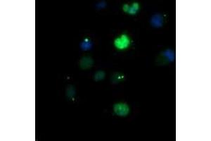 Image no. 1 for anti-Early Growth Response 2 (EGR2) (AA 156-476) antibody (ABIN1490983) (EGR2 antibody  (AA 156-476))