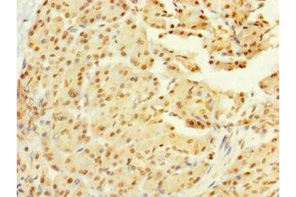 GALK2 antibody  (AA 161-458)