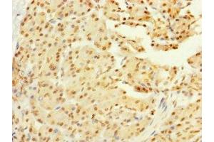 Immunohistochemistry of paraffin-embedded human pancreatic tissue using ABIN7160672 at dilution of 1:100 (GALK2 antibody  (AA 161-458))