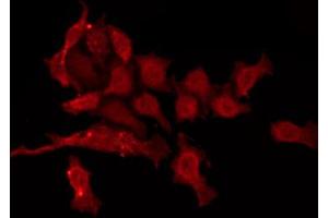 ABIN6274427 staining HepG2 by IF/ICC. (CAMKV antibody  (Internal Region))