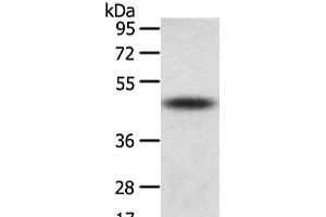 Western Blot analysis of Mouse adrenal gland tissue using TTC23 Polyclonal Antibody at dilution of 1/800 (TTC23 antibody)