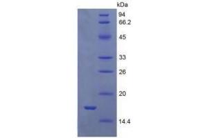 Image no. 1 for Growth Differentiation Factor 9 (GDF9) (AA 320-454) (Active) protein (His tag) (ABIN6239856)