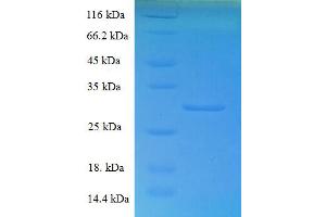 SDS-PAGE (SDS) image for Coactosin-Like Protein (AA 2-142) protein (His-SUMO Tag) (ABIN5711307) (COTL1 Protein (AA 2-142) (His-SUMO Tag))