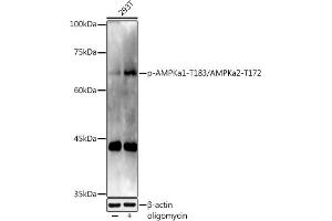Western blot analysis of extracts of 293T cells, using Phospho-AMPKa1-T183/AMPKa2-T172 antibody (ABIN3020441, ABIN3020442, ABIN3020443 and ABIN1681942) at 1:1000 dilution. (AMPK alpha antibody  (pThr172))
