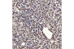 IHC analysis of TOM1L1 using anti-TOM1L1 antibody (ABIN7602631).