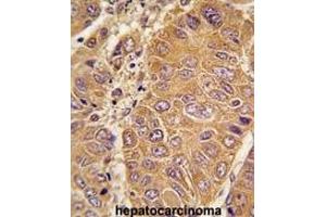 Immunohistochemistry (Paraffin-embedded Sections) (IHC (p)) image for anti-Apolipoprotein A-I (APOA1) (AA 10-37), (N-Term) antibody (ABIN391612)