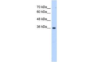 LOC339879 antibody used at 2. (ALG1L6P antibody  (C-Term))