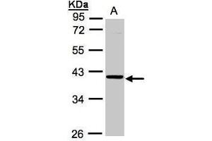 WB Image Sample (30μg whole cell lysate) A:A431, 10% SDS PAGE antibody diluted at 1:1000
