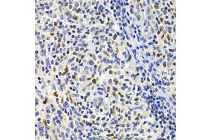Immunohistochemistry of paraffin-embedded human lymphonodus using GEMIN2 Antibody (ABIN1872798) at dilution of 1:200 (40x lens). (SIP1 antibody)