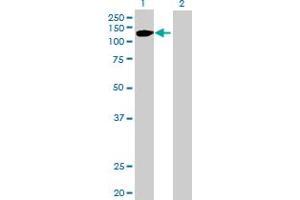 Western Blot analysis of FGFR2 expression in transfected 293T cell line by FGFR2 MaxPab polyclonal antibody.