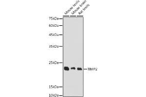 Western blot analysis of extracts of various cell lines, using TIMP2 antibody (ABIN7268483) at 1:1000 dilution.
