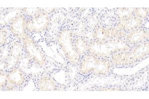 Detection of S100A3 in Human Kidney Tissue using Monoclonal Antibody to S100 Calcium Binding Protein A3 (S100A3) (S100A3 antibody  (AA 1-101))