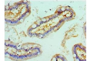 Immunohistochemistry of paraffin-embedded human small intestine tissue using ABIN7168003 at dilution of 1:100 (ROCK2 antibody  (AA 1109-1388))