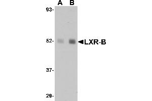 Western blot analysis of LXR-B in human lung tissue lysate with LXR-B antibody at (A) 1 and (B) 2 µg/mL.