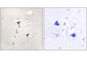 Immunohistochemistry analysis of paraffin-embedded human brain tissue, using PKD1/PKC mu (Ab-205) Antibody. (PKC mu antibody  (AA 171-220))