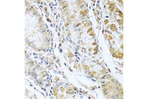 Immunohistochemistry of paraffin-embedded human stomach using RN antibody  at dilution of 1:100 (40x lens). (RNASE13 antibody  (AA 1-156))