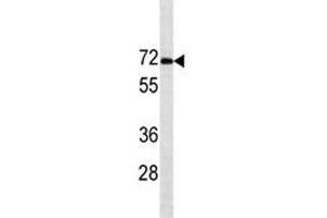 Estrogen Receptor alpha antibody western blot analysis in MCF-7 lysate.