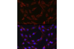 Immunofluorescence analysis of C6 cells using cI Rabbit pAb (ABIN1678920, ABIN3015349, ABIN3015350 and ABIN6213998) at dilution of 1:50 (40x lens). (BIRC3 antibody  (AA 1-180))