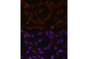 Immunofluorescence analysis of C6 cells using cI Rabbit pAb (ABIN1678920, ABIN3015349, ABIN3015350 and ABIN6213998) at dilution of 1:50 (40x lens). (BIRC3 antibody  (AA 1-180))