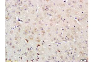 Formalin-fixed and paraffin embedded rat brain labeled with Rabbit Anti IRS-4 Polyclonal Antibody, Unconjugated (ABIN726020) at 1:200 followed by conjugation to the secondary antibody and DAB staining (IRS4 antibody  (AA 401-500))