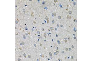 Immunohistochemistry of paraffin-embedded mouse brain using PTK7 antibody. (PTK7 antibody  (AA 811-1070))