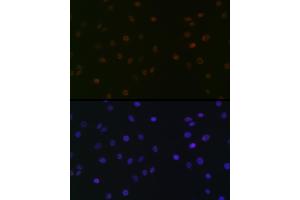 Immunofluorescence analysis of C6 cells using SUPT5H/SPT5 Rabbit mAb (ABIN7270878) at dilution of 1:100 (40x lens). (SUPT5H antibody)