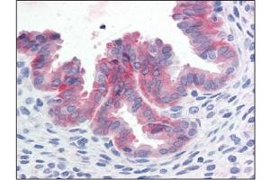 Immunohistochemistry (IHC) image for anti-Met Proto-Oncogene (MET) (Cytoplasmic Domain) antibody (ABIN614469) (c-MET antibody  (Cytoplasmic Domain))