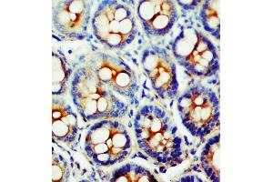 Anti-SSTR1 antibody, IHC(P) IHC(P): Rat Intestine Tissue (SSTR1 antibody  (C-Term))