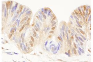 Immunohistochemistry (IHC) image for anti-Cell Division Cycle 25 Homolog C (S. Pombe) (CDC25C) (AA 150-200) antibody (ABIN7454534) (CDC25C antibody  (AA 150-200))